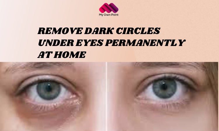 Remove Dark Circles Under Eyes Permanently